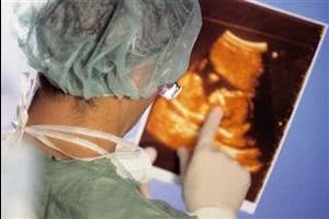 Двурогая матка и беременность: типы патологии, методы диагностики, отзывы