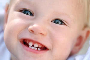  Кариес молочных зубов: причины, лечение, что делать при кариесе