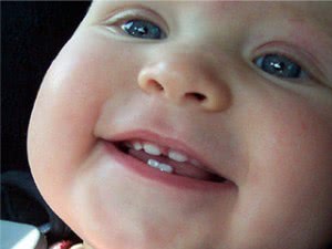 Первые зубы у ребенка: симптомы прорезывания, как помочь ребенку
