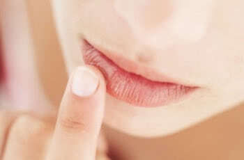 Как быть с потрескавшимися губами
