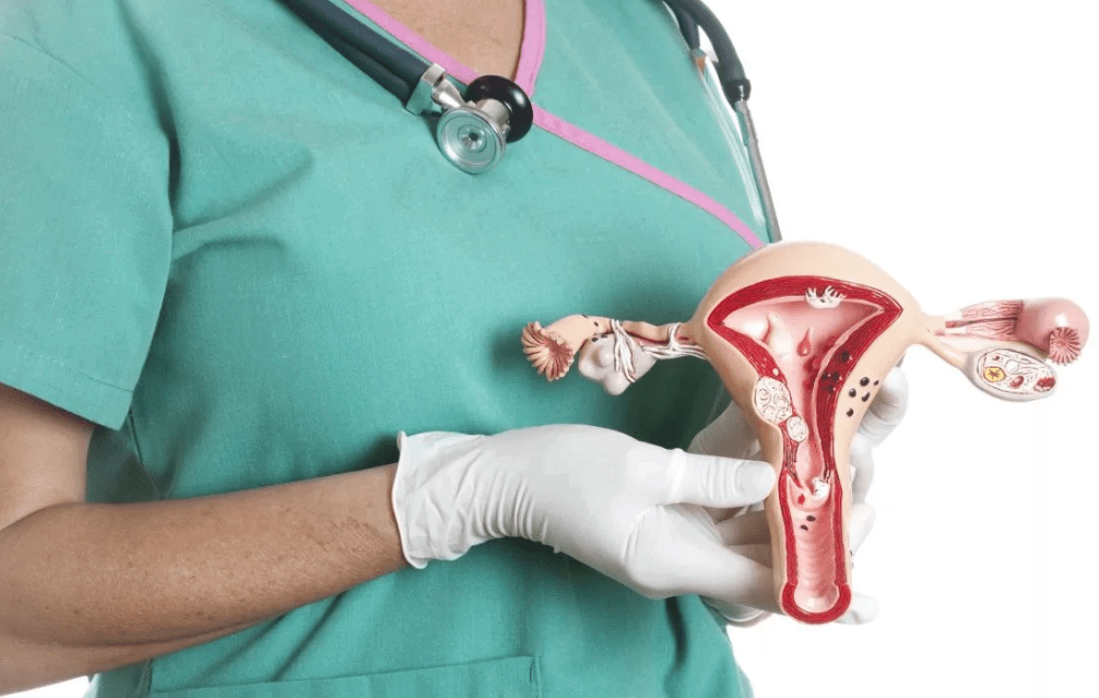 Как лечить воспаление яичника у женщин