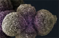 Лечение рака яичников: новые генетические методы