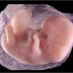 На свалке был найден 19-недельный эмбрион человека