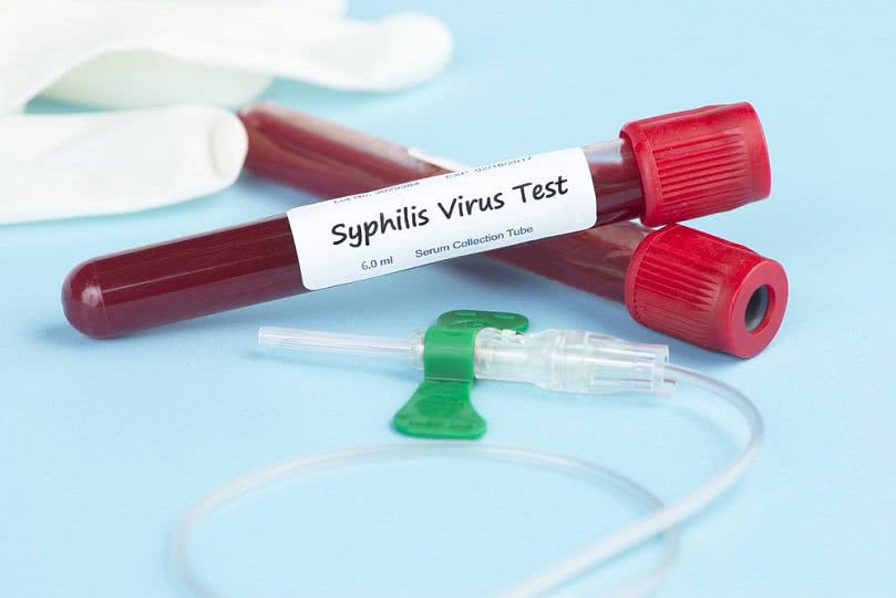 Первичный сифилис: как проявляется инфекция?