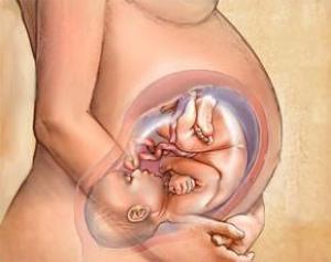 Родить после аборта