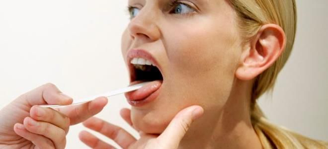 Стафилококк в горле – симптомы