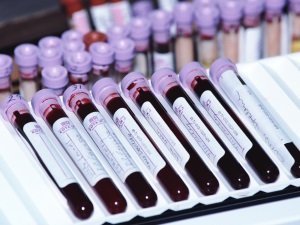 Анализ крови матери для выявления патологии