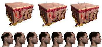 Фазы изменения волосяного покрова головы