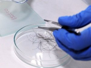Определение употребления наркотической травки по волосам