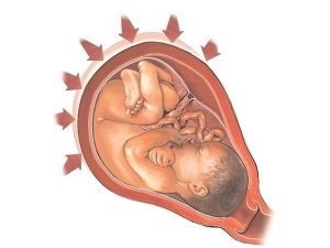 Проблема гипертонуса матки при беременности